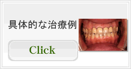 具体的な治療例